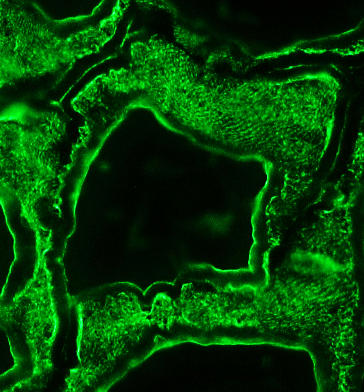 Figure 1. Swine skeletal muscle showing the typical alpha-actin striated staining pattern with MUB0108P (clone 3B3).